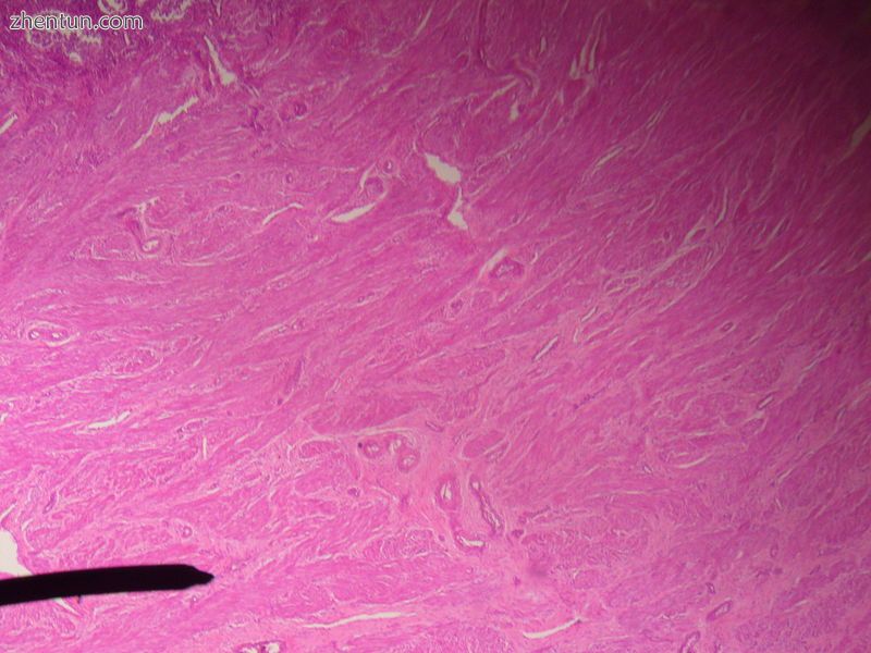 Microscopic slide of the myometrium..jpg