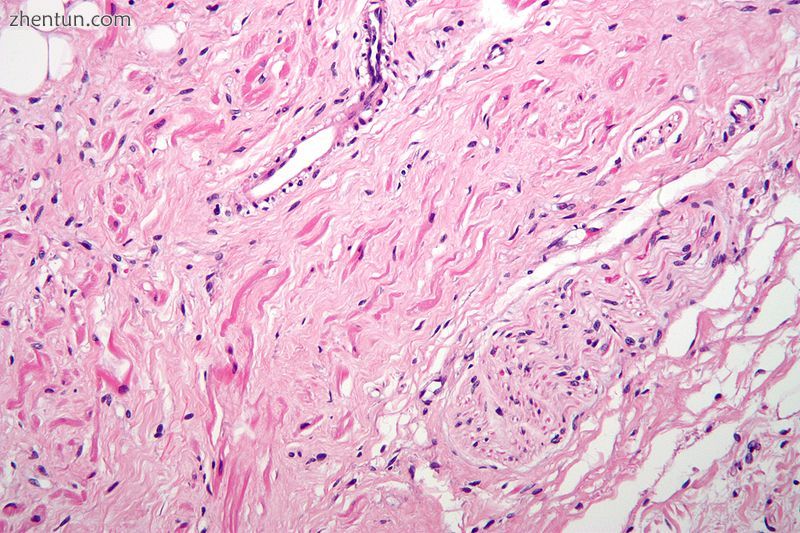 H&amp;E stained fibers of the vagus nerve (bottom right) innervate the sinoatrial .jpg