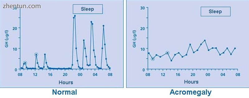 Frequent serum GH measurements in normal subjects.jpg