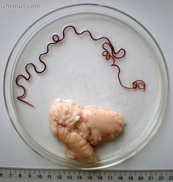 卵巢 of a marine fish and its parasite, the nematode Philometra fasciati.jpg