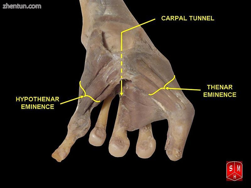 Carpal tunnel and thenar and hypothenar eminences.jpg