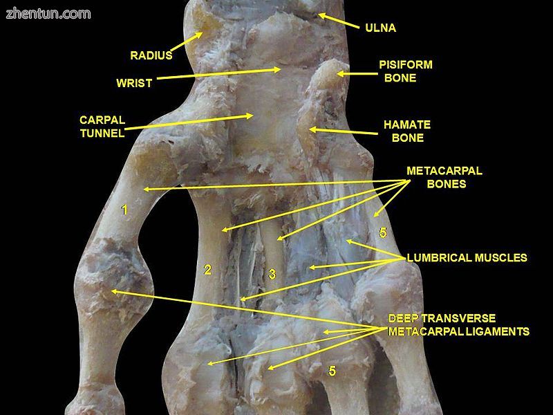 Wrist joint. 3Deep dissection.Anterior, palmar, view..jpg