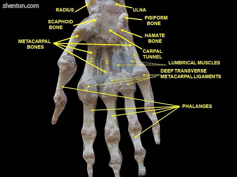 Wrist joint. Deep dissection.Anterior, palmar, view..jpg