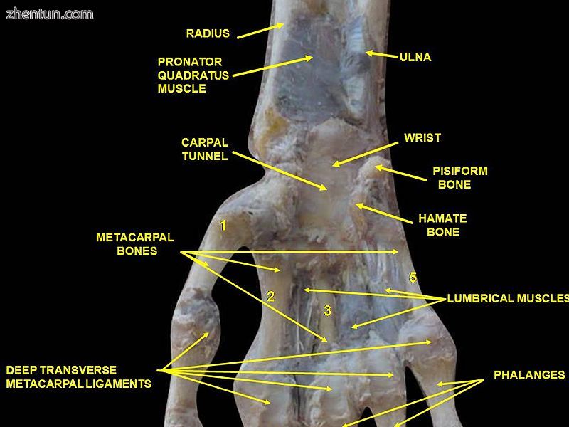 Wrist joint. Deep dissection.Anterior, palmar, view.2.jpg