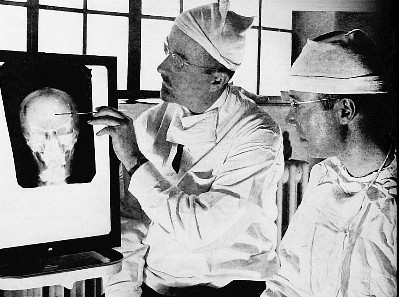 Dr. Walter Freeman, left, and Dr. James W. Watts study an X ray befo.jpg