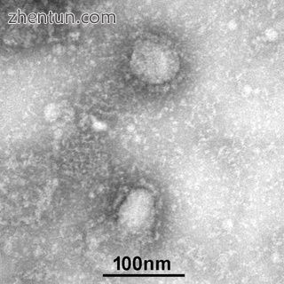 Transmission electron micrograph of two 2019-nCoV virions.jpg