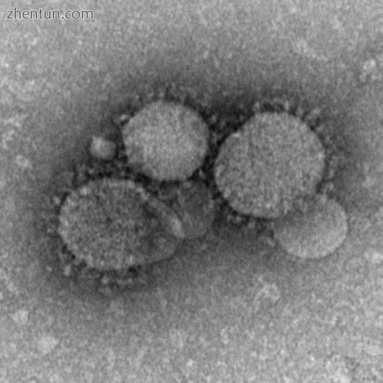 MERS-CoV particles as seen by negative stain electron microscopy. Virions contai.jpg