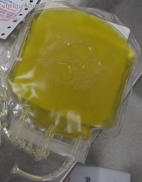 A unit of donated fresh plasma.jpg