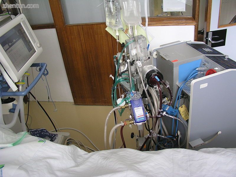 ECMO circuit.jpg