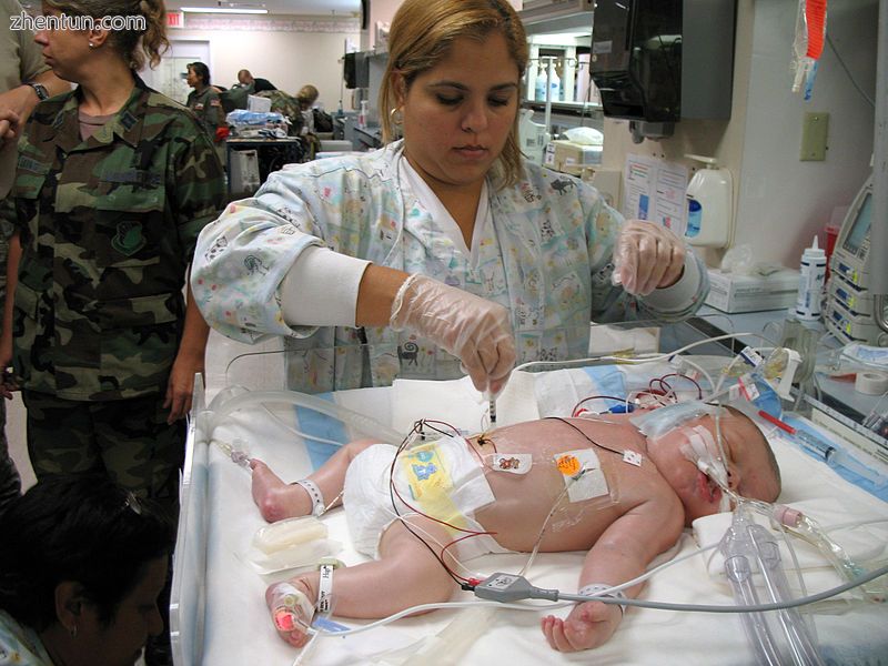 A respiratory therapist takes a blood sample from a newborn in preparation for E.jpg