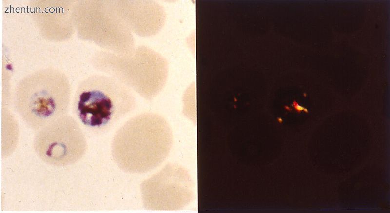 Hemozoin formation in P. falciparum.jpg