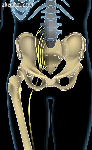Right gluteal region, showing surface markings for arteries and sciatic nerve.jpg