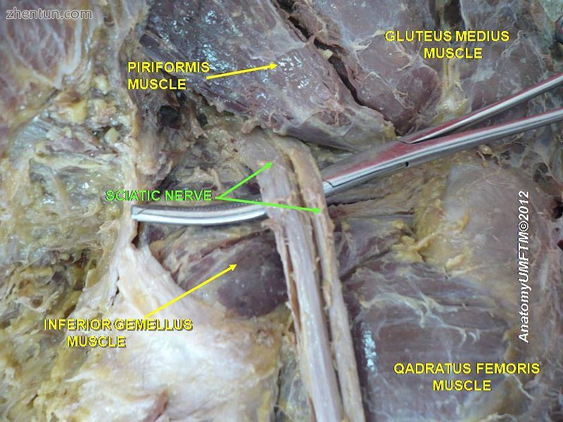 Sciatic nerve.4.jpg