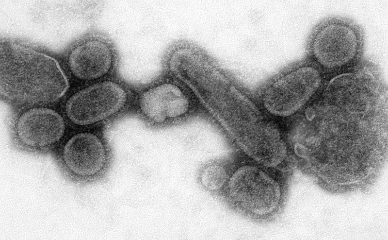 An electron micrograph showing recreated 1918 influenza virions.jpg