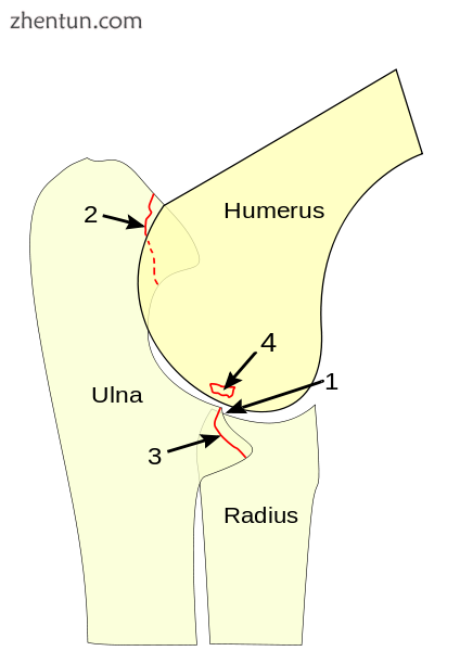 The capitellum is the rounded knob on the end of the humerus, and it is held by .png
