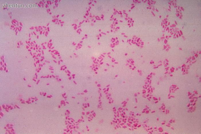 Bacteroides fragilis.jpg