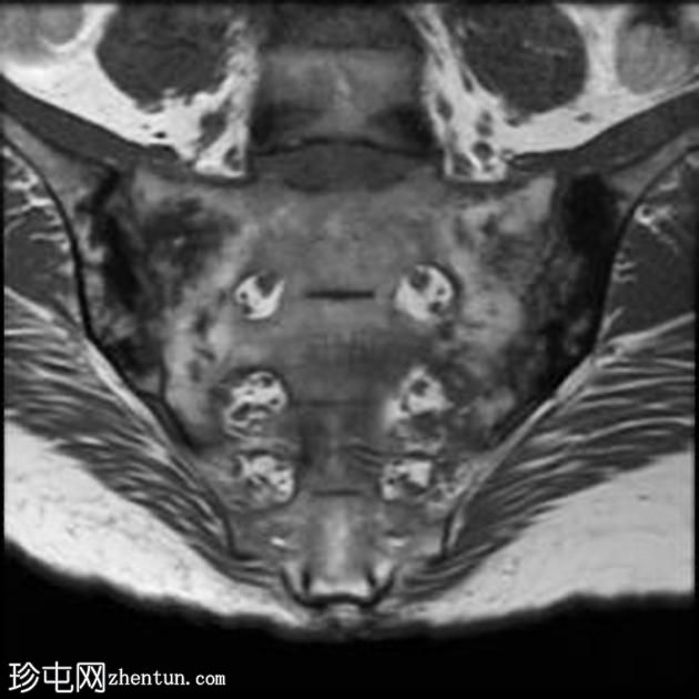 ǿֱԼ (MRI)