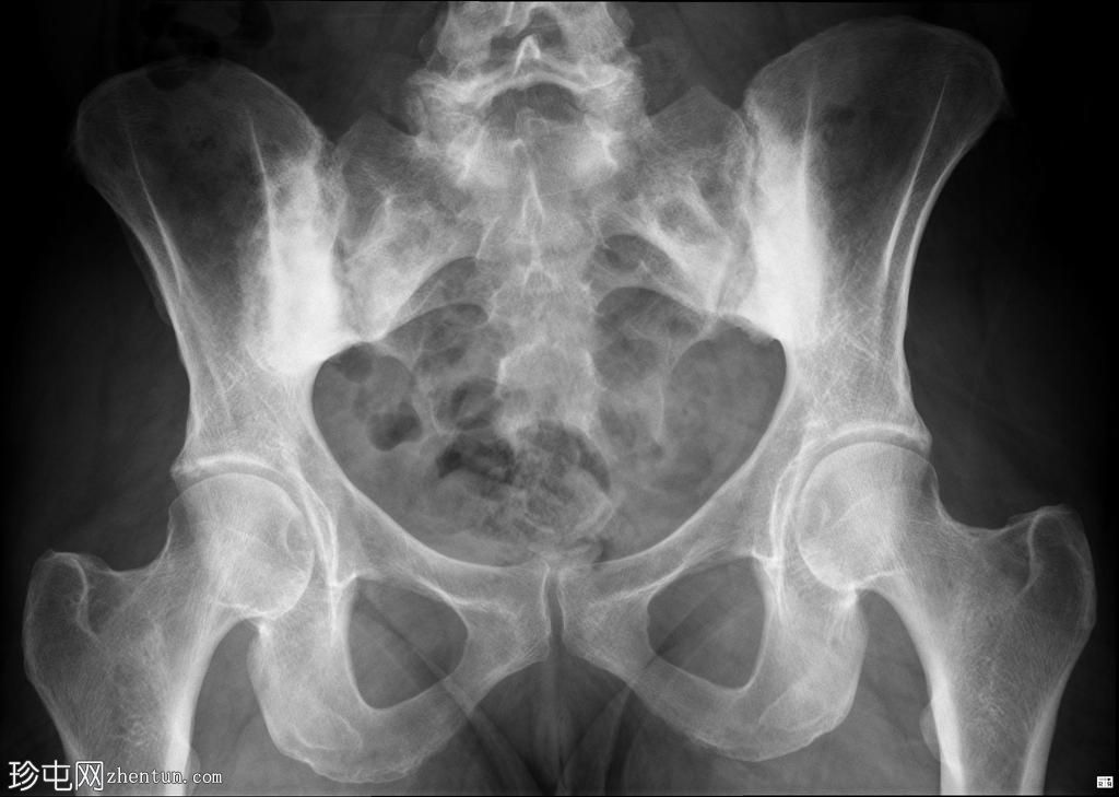 ǿֱԼ (MRI)