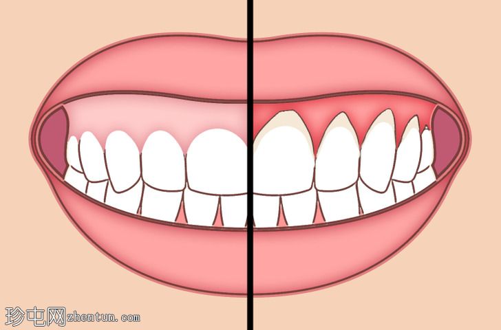 你的牙齿会感谢你养成的6个日常习惯