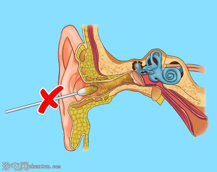 如何清洁耳朵