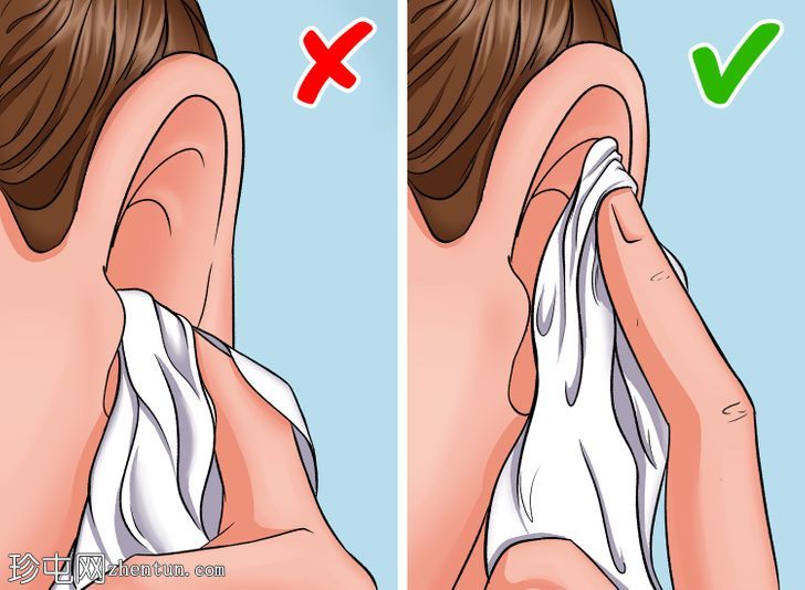如何清洁耳朵