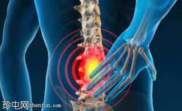 不用手术治疗慢性背痛的方法