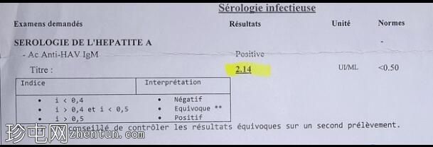 急性甲型病毒性肝炎