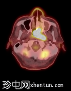 7.png